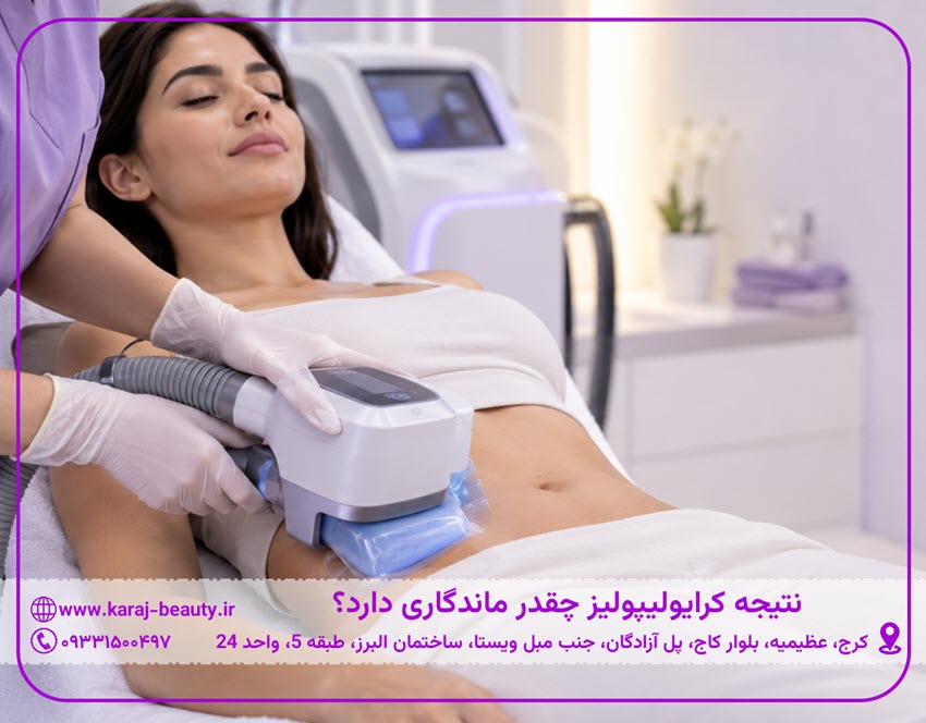 نتیجه کرایولیپولیز چقدر ماندگاری دارد؟ | کلینیک زیبایی آنسه در آزادگان کرج