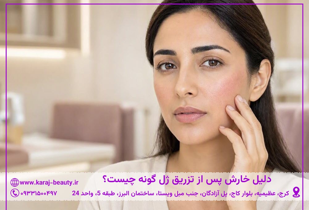 علت خارش بعد از تزریق ژل | کلینیک زیبایی آنسه در آزادگان کرج