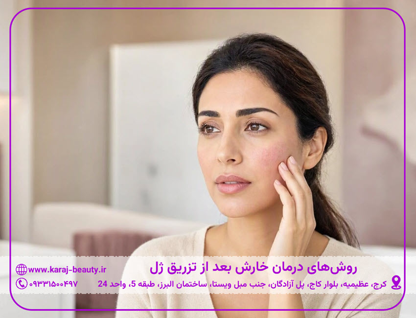 برای درمان خارش بعد از تزریق ژل چه کنیم؟ | کلینیک زیبایی آنسه در عظیمیه کرج