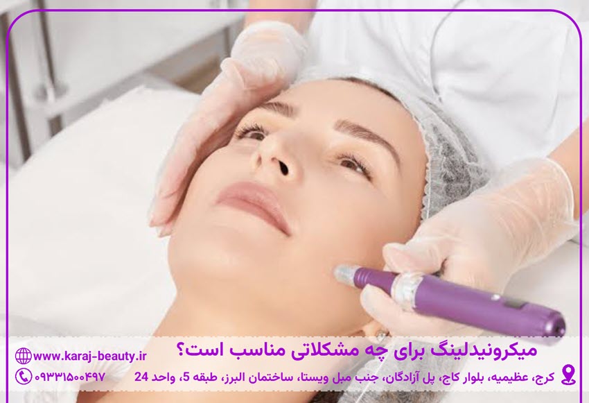 میکرونیدلینگ برای چه مشکلاتی مناسب است؟ | کلینیک پوست و زیبایی آنسه در عظیمیه کرج