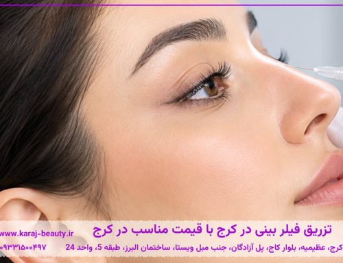 تزریق فیلر بینی در کرج | هزینه، مزایا، عوارض و ماندگاری
