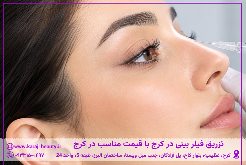 تزریق فیلر بینی در کرج | کلینیک زیبایی آنسه در عظیمیه کرج